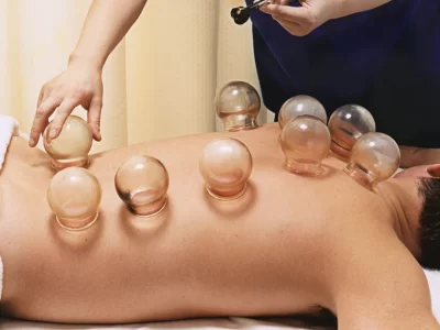 cupping therapy Denver